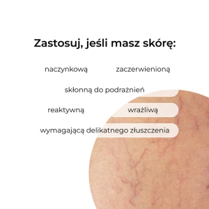 Veoli Botanica Redness Rescue Peel Beruhigend-glättendes Peeling für empfindliche Haut 30 ml