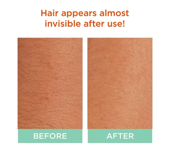 Kliknij na zdjęcie, aby je powiększyć Sally Hansen Set zum Aufhellen der Gesichts- und Körperbehaarung: Creme 50 ml + Aktivator 50 ml