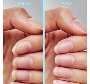 SALLY HANSEN REPAIR + RESCUE NAGELKUR 13,3ML 55